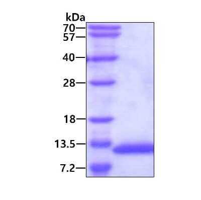 SDS-PAGE: Recombinant Human VAMP-5 His Protein [NBC1-22935]